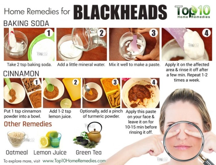 Diy to get rid of blackheads